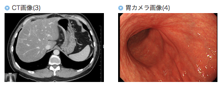 全分子フコイダンエキス