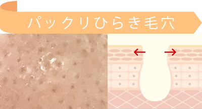 年齢毛穴 小鼻 角栓 除去