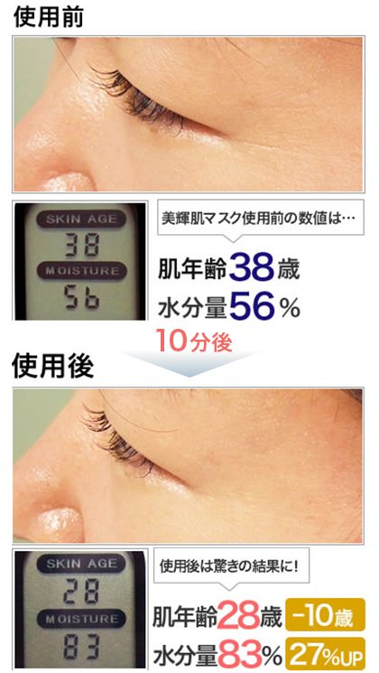 ニキビに効くパック「美輝肌マスク」の効果ない？オールインワンシートマスクの口コミ掲載