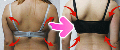 脇肉移動　ブラ