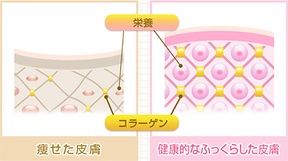 aikirara アイキララ　口コミ