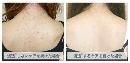 ジュエルレイン 口コミ