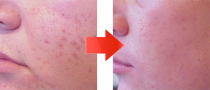 スウィートローズオールインワンゲル