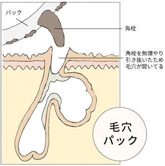 毛穴パック