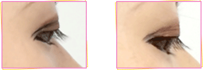 ぱっちりウィンク 口コミ