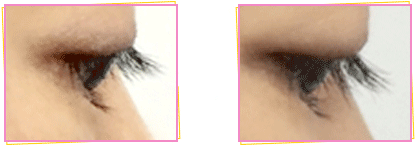 ぱっちりウィンク 口コミ