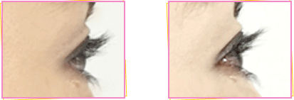 ぱっちりウィンク 口コミ