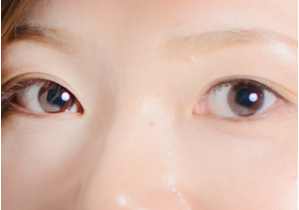 アイキララ 口コミ