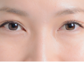 アイキララ 口コミ