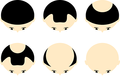 美容師がおすすめするメンズシャンプー「CU（チャップアップ）シャンプー」の口コミって？