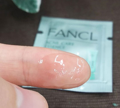 毛穴・角栓詰まり、大人ニキビを知らずのツルツル肌になれる『無添加　ファンケル　ドクターシリーズ　アクネケア1ヶ月おためしキット』を徹底検証！