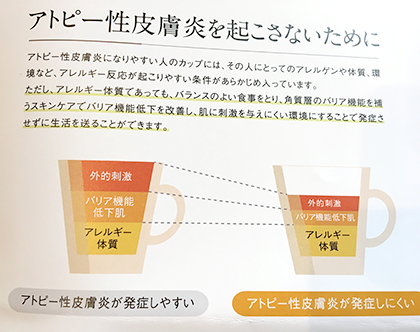 アトピー性皮膚炎を起こさないために