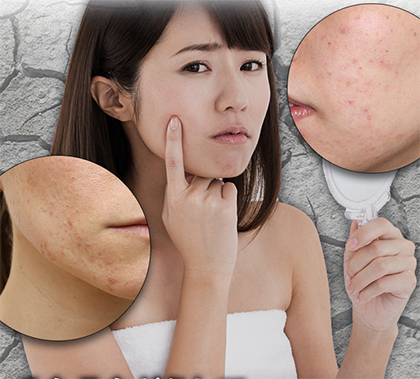 ピュアレーヌの特徴