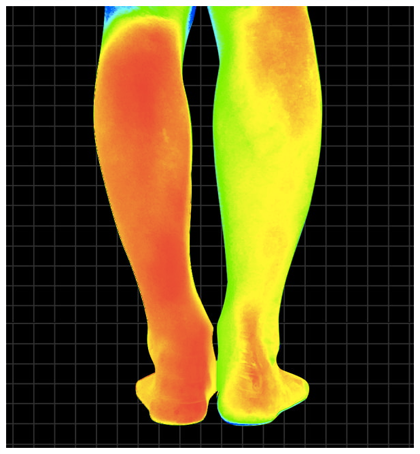 倖田來未のダイエット靴下「BIKYAQUEEN(ビキャクイーン)」の最安値と口コミを徹底調査!